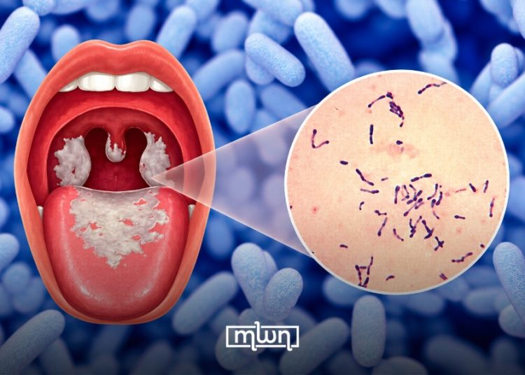 Moroccan Expert Calls for Action to Close Diphtheria Vaccination Gaps