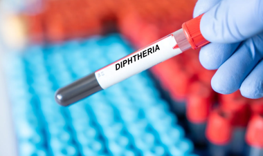 Two children die of diphtheria in Salé as Morocco confronts return of rare disease