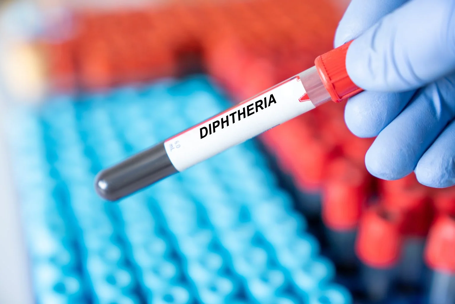 Two children die of diphtheria in Salé as Morocco confronts return of rare disease