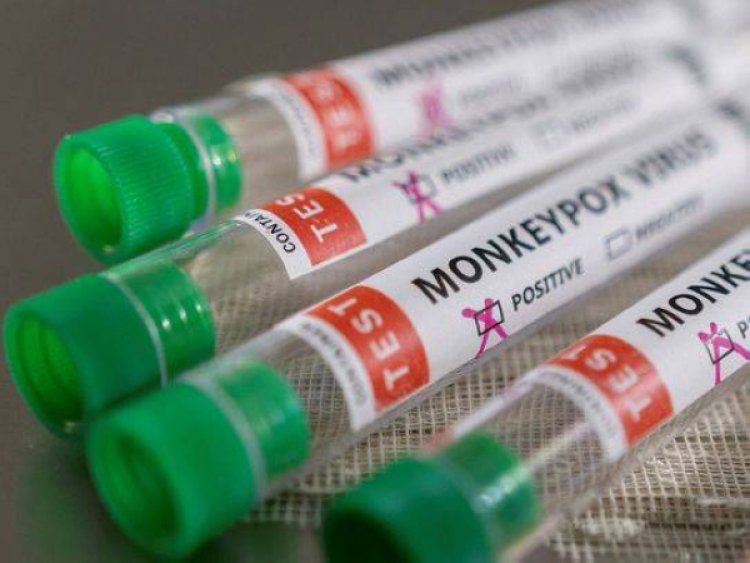 UAE announces 3 new cases of monkeypox