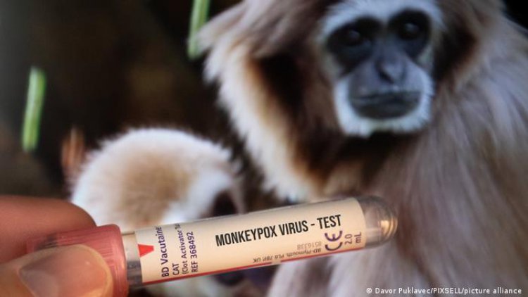 كندا : رصد 100 اصابة بفيروس جدري القرود