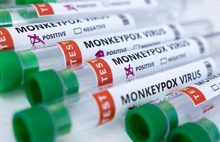 Sudan reports first monkeypox case