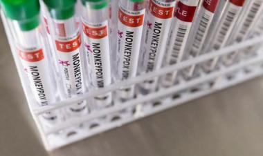 Bahrain receives WHO monkeypox test kits