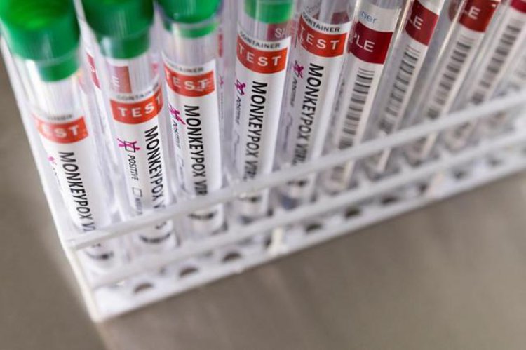 Bahrain receives WHO monkeypox test kits