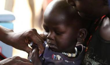 خلال أسبوعين... الحصبة تودي بحياة أكثر من 150 طفلاً في زيمبابوي