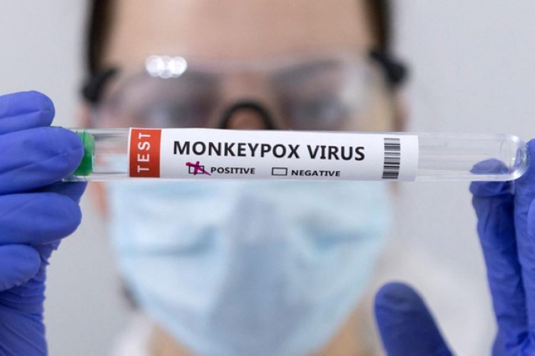 البحرين تعلن تسجيل أول إصابة بفيروس جدري القرود