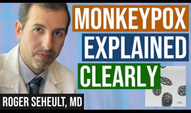 Monkeypox Explained Clearly